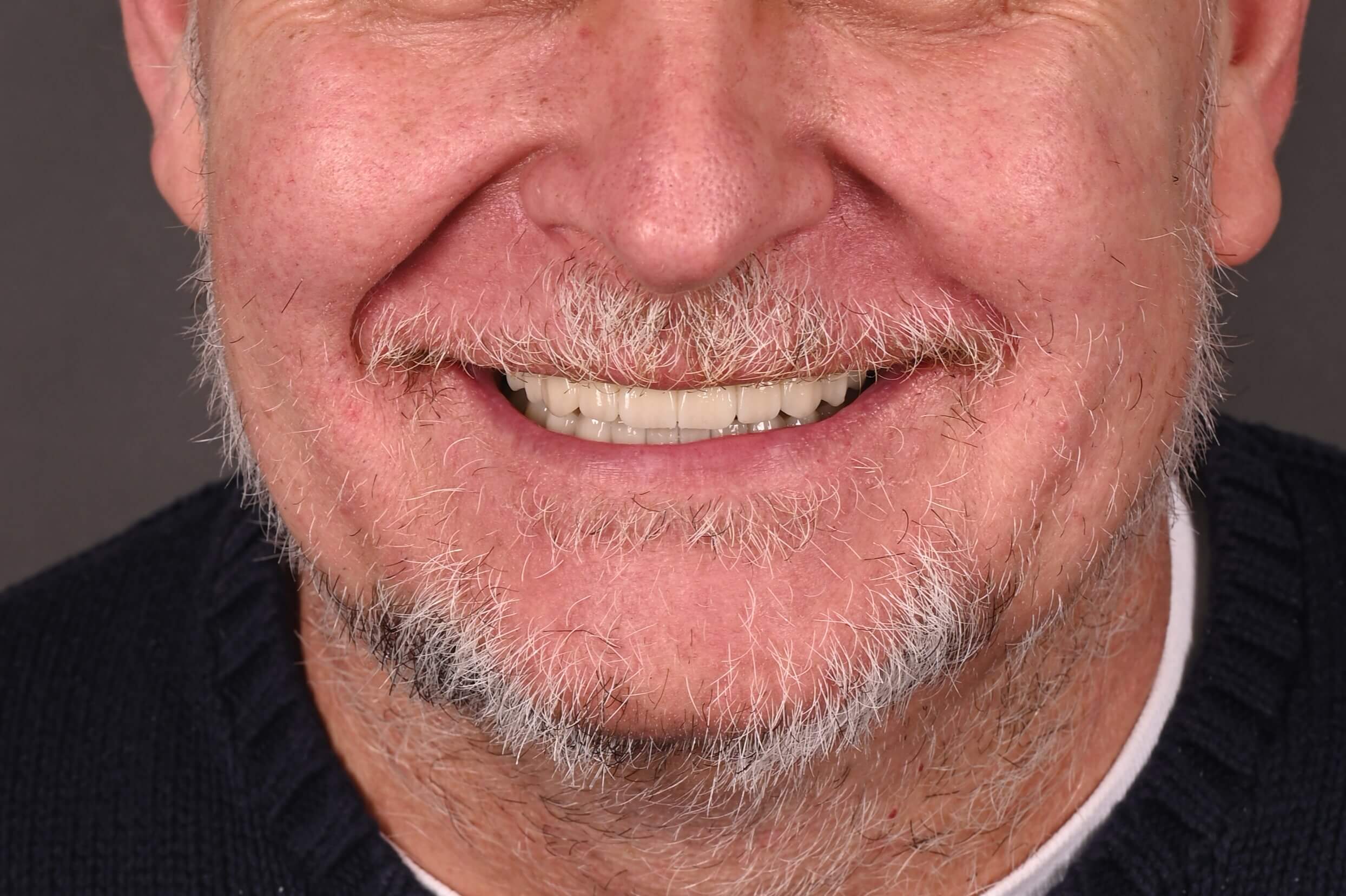 patrahau dragos - dupa